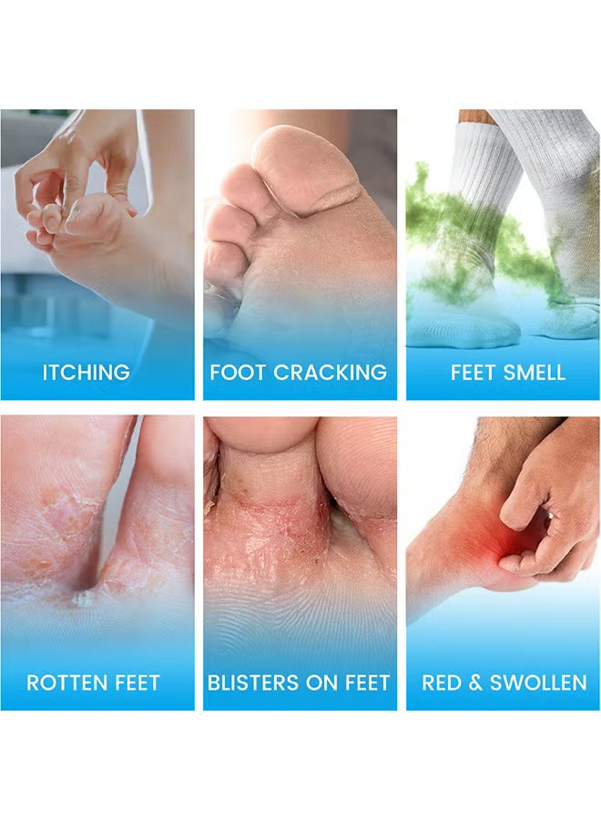 Foot Antibacterial Cream,Athlete's Foot Odor Foot Cream, Antifungal Cream,