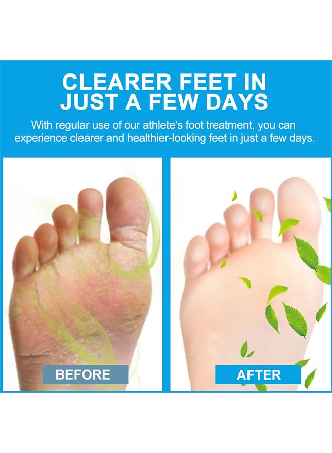 Foot Antibacterial Cream,Athlete's Foot Odor Foot Cream, Antifungal Cream,